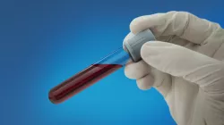 Guardant Health Announces Results of Its CRC Blood Test Study